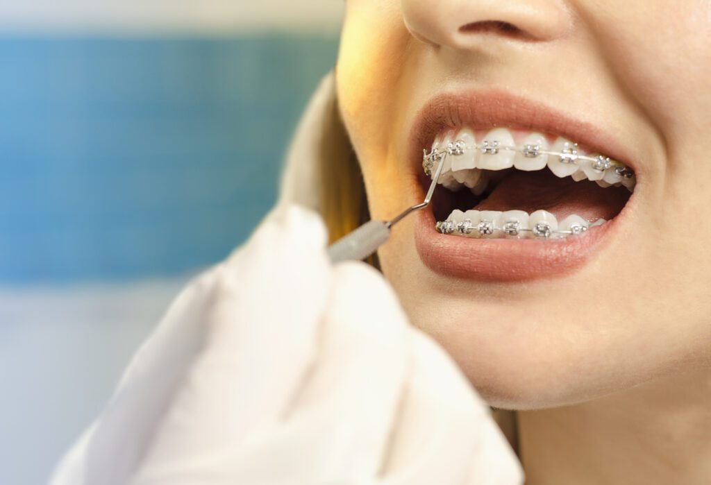 Treating Orthodontic Problems in Mt. Airy, Maryland
