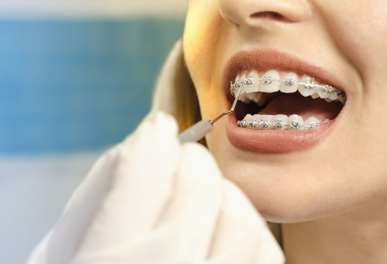 The Most Common Orthodontic Problems Mt. Airy MD Dentist